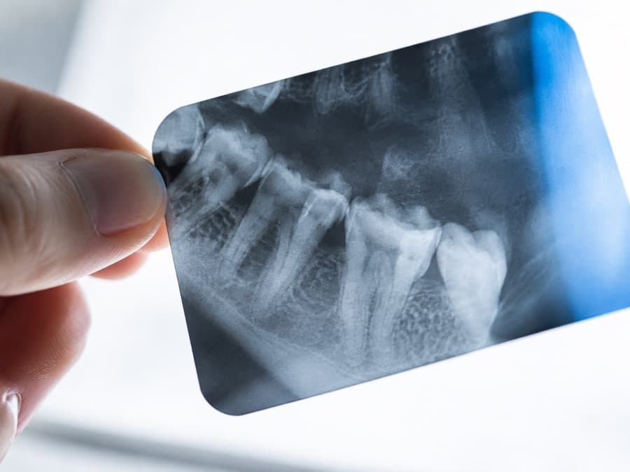 Imagine editorială pentru centre de radiologie dentară