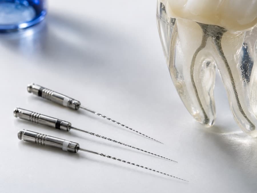 Imagine editorială despre endodonție