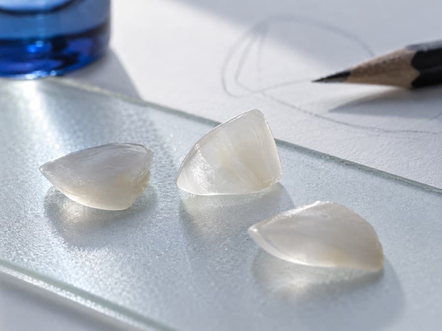 Imagine editorială despre estetică dentară